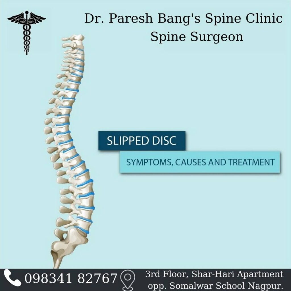 Slipped Disc Symptoms